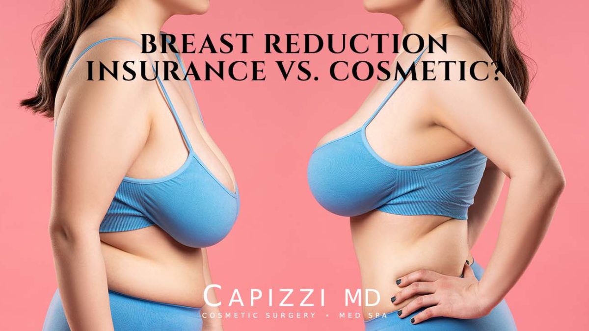 Successfully Submitting an Insurance Claim for Breast Reduction Surgery